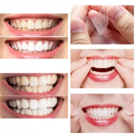 Отбеливающая дневная полоска для зубов с экстрактом кокоса и ментола LANBENA Teeth Whitening Strips